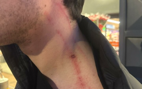 Aggressione di un giovane alla stazione di Sezze: l’appello del padre