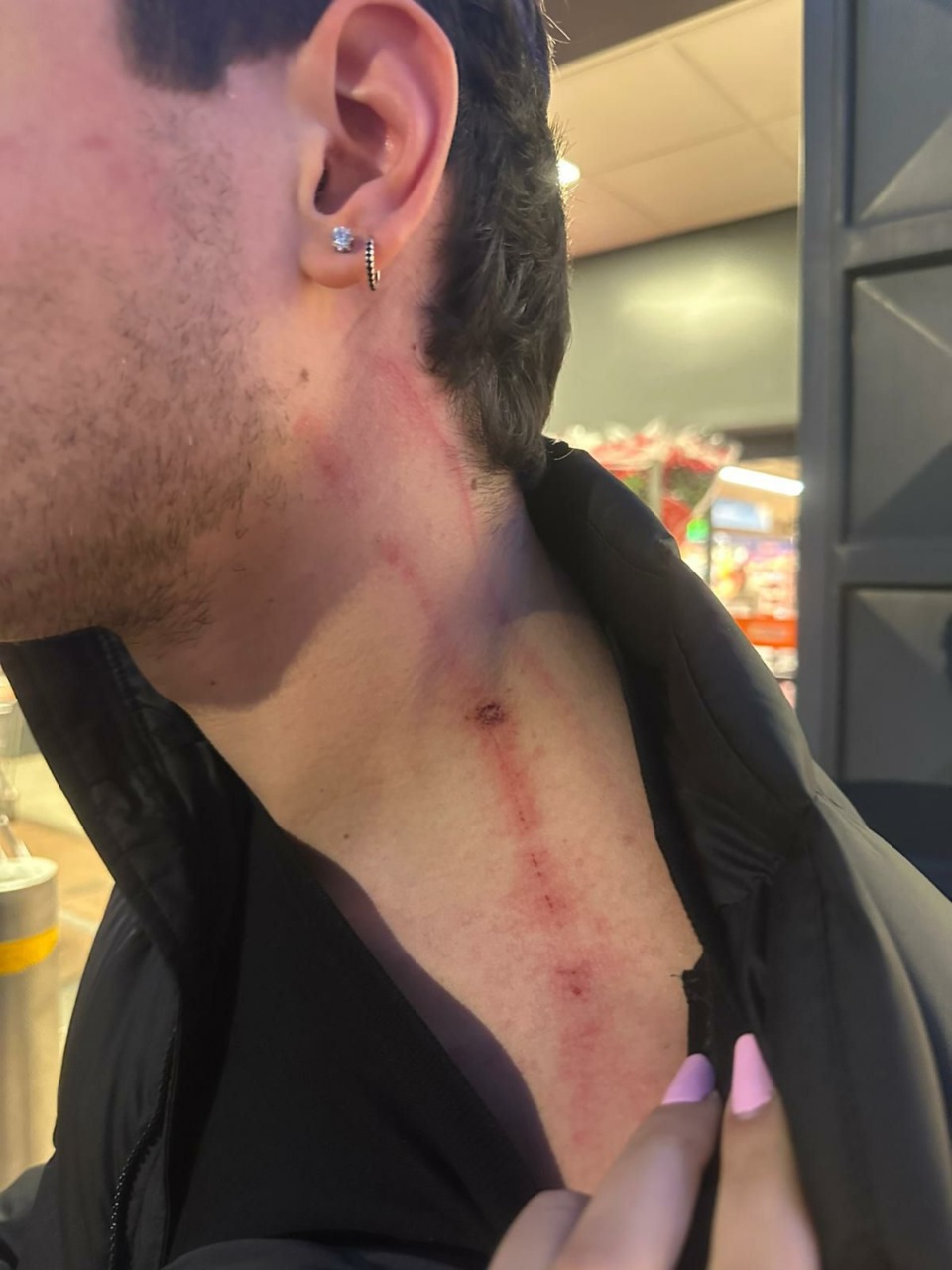 Aggressione di un giovane alla stazione di Sezze: l’appello del padre