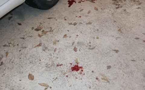 Tre rapine in poche settimane: il tabaccaio finisce in ospedale e pensa a una pistola